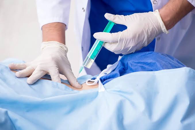 Ozone Therapy for Disc Prolapse